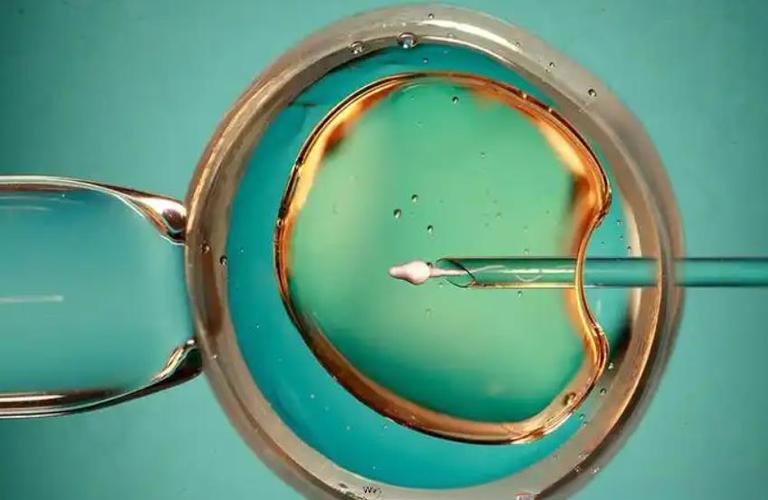 单身去吉尔吉斯斯坦做三代试管生子可以吗？