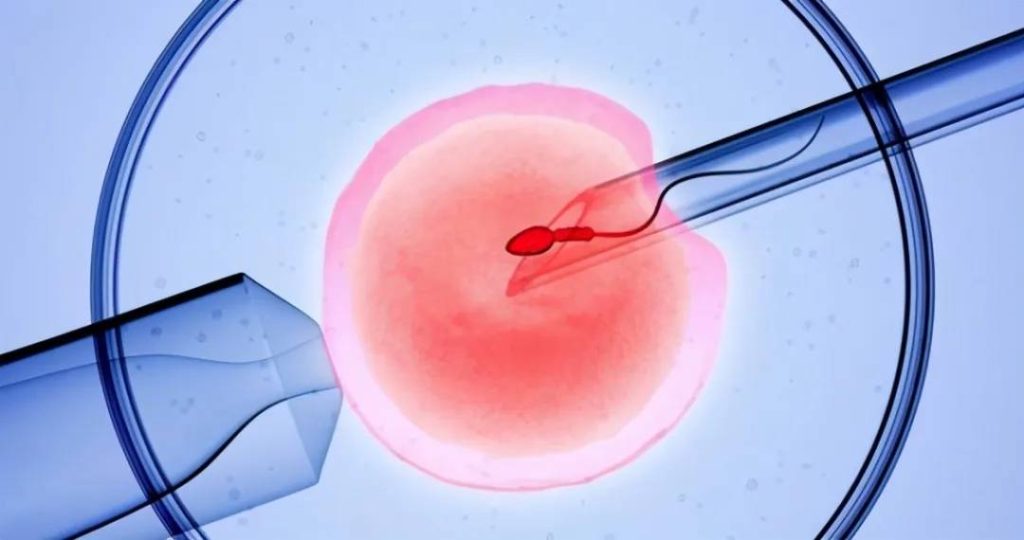 吉尔吉斯斯坦试管攻略：你的精子卵子达标了吗？